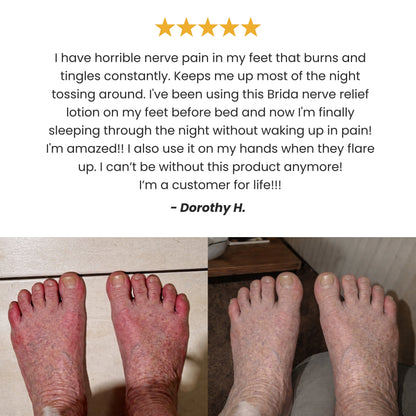 Brida Nerve Relief Lotion